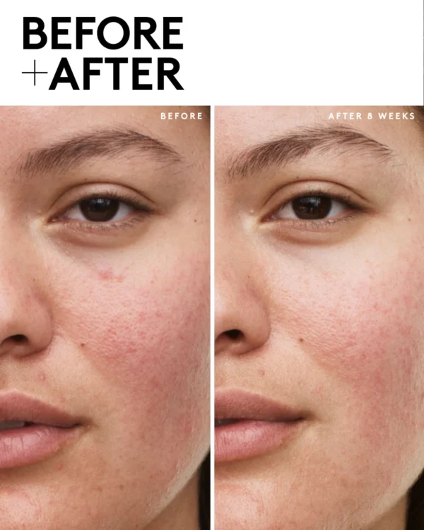 Fenty Skin Start’rs Full-Size Bundle: Dry Skin Edition - Image 2