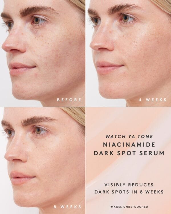 WATCH YA TONE NIACINAMIDE DARK SPOT SERUM - Image 2